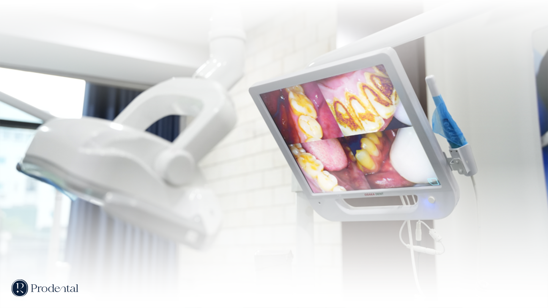 MAY SOI KHOANG MIENG