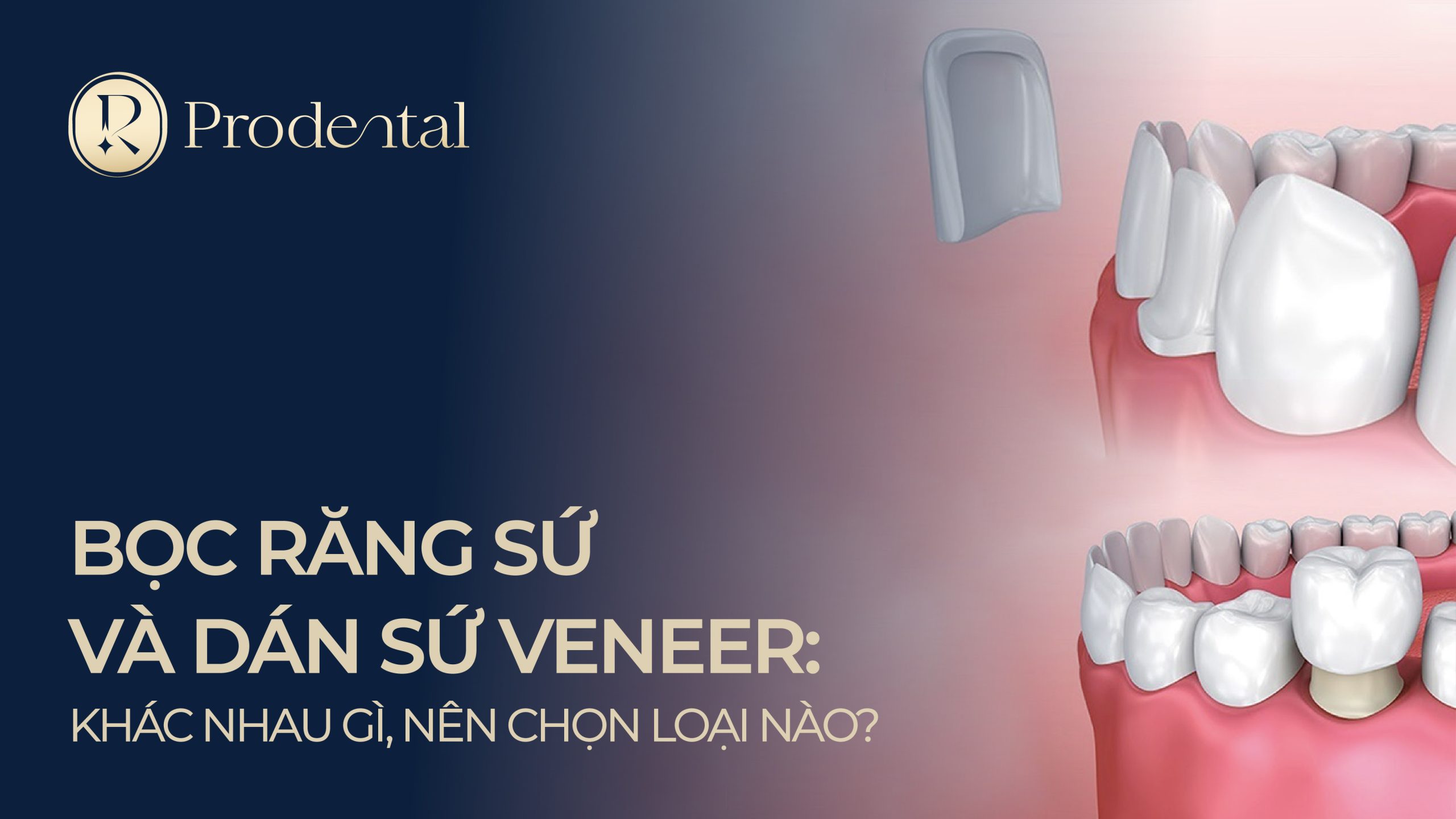 Boc va dan su 4 scaled