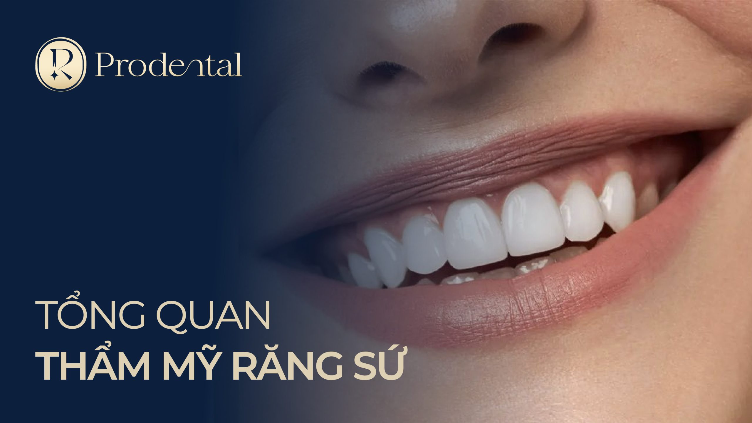 Tổng quan thẩm mỹ răng sứ 01 scaled