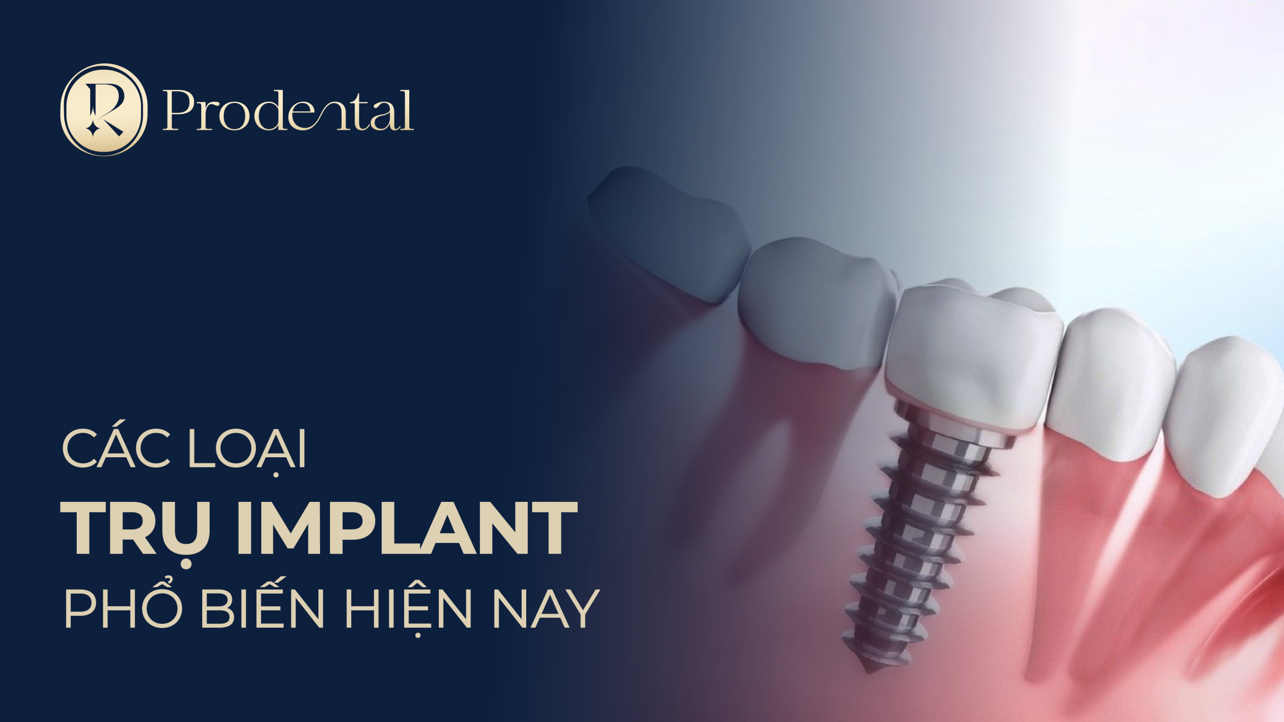 Trụ Implant 11 scaled
